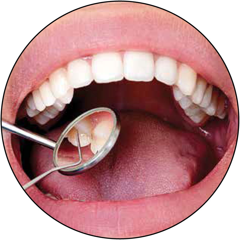 3.5x-classic-expanded-field-dental-2.png